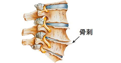 隆回长岭中医医院,隆回颈椎病,隆回腰椎病,隆回关节病,隆回风湿病,隆回股骨头坏死