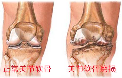 隆回长岭中医医院,隆回颈椎病,隆回腰椎病,隆回关节病,隆回风湿病,隆回股骨头坏死