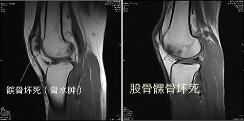 隆回长岭中医医院,隆回颈椎病,隆回腰椎病,隆回关节病,隆回风湿病,隆回股骨头坏死