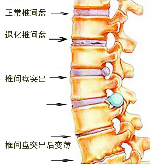 隆回长岭中医医院,隆回颈椎病,隆回腰椎病,隆回关节病,隆回风湿病,隆回股骨头坏死